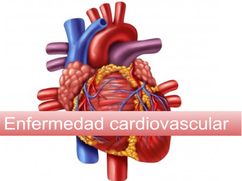 Enfermad cardiovascular puzzle